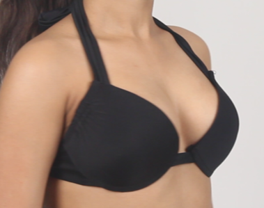 Breast augmentation implant surgery